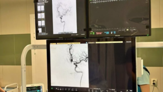 В Лабинской ЦРБ провели первую операцию по эмболизации аневризмы головного мозга